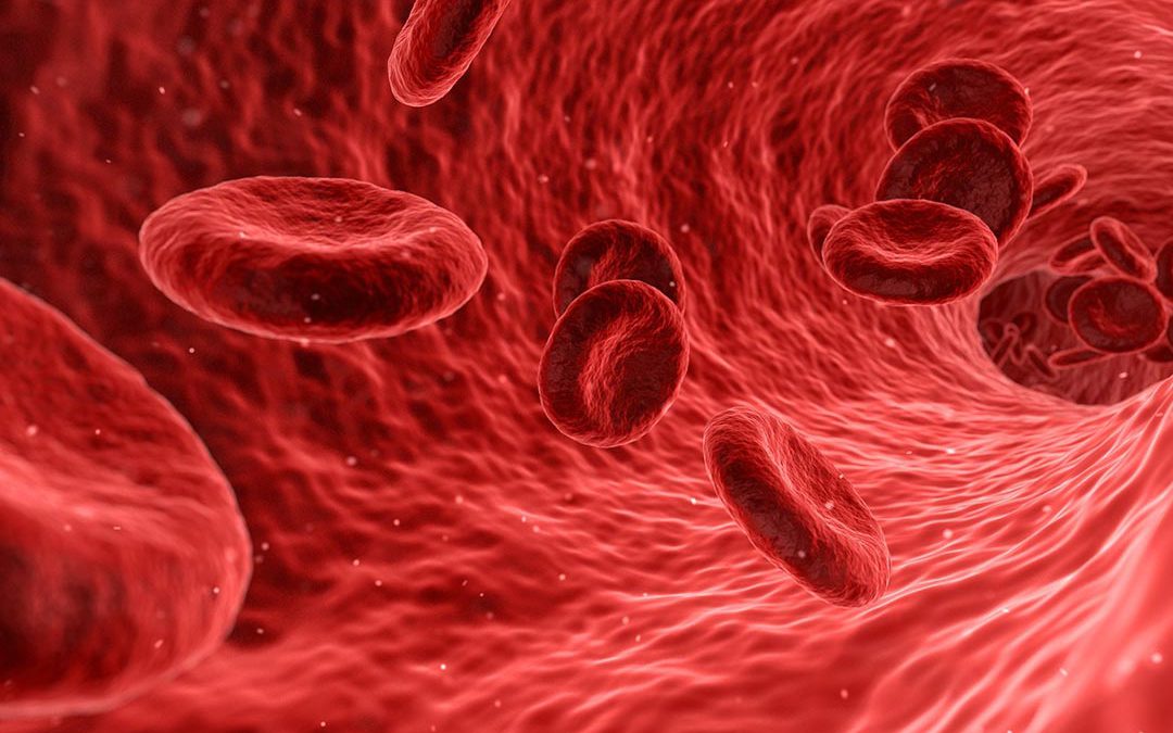 Anemia